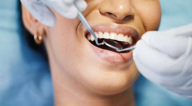 Best Dental Abscess Treatment in Huntington, TX